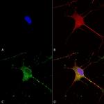 SUR1 Antibody in Immunocytochemistry (ICC/IF)