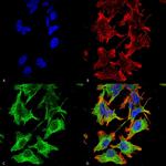 NMDAR1 Antibody in Immunocytochemistry (ICC/IF)