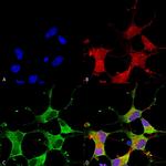 GIT1 Antibody in Immunocytochemistry (ICC/IF)