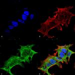 GIT1 Antibody in Immunocytochemistry (ICC/IF)