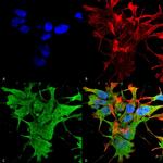 Dicer Antibody in Immunocytochemistry (ICC/IF)