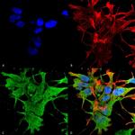 Dicer Antibody in Immunocytochemistry (ICC/IF)