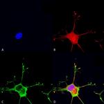 Dicer Antibody in Immunocytochemistry (ICC/IF)