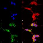 NALCN Antibody in Immunocytochemistry (ICC/IF)