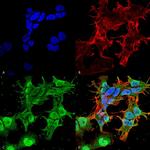 CACNG2/4/8 Antibody in Immunocytochemistry (ICC/IF)