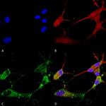 CACNG2/4/8 Antibody in Immunocytochemistry (ICC/IF)