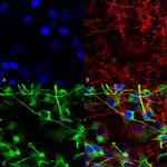 NMDAR2A Antibody in Immunocytochemistry (ICC/IF)