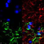 SUR2A Antibody in Immunocytochemistry (ICC/IF)