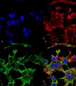 PTPRF Antibody in Immunocytochemistry (ICC/IF)