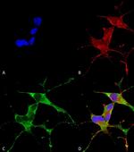 LRRK2 Antibody in Immunocytochemistry (ICC/IF)