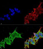 LRRK2 Antibody in Immunocytochemistry (ICC/IF)