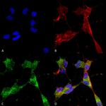 PINK1 Antibody in Immunocytochemistry (ICC/IF)