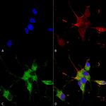 SHANK1/SHANK3 Antibody in Immunocytochemistry (ICC/IF)