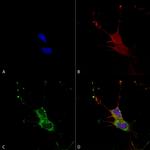 LGI1 Antibody in Immunocytochemistry (ICC/IF)