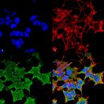 LGI1 Antibody in Immunocytochemistry (ICC/IF)