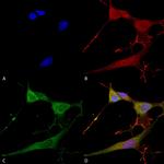 NRCAM Antibody in Immunocytochemistry (ICC/IF)