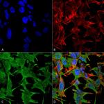 NRCAM Antibody in Immunocytochemistry (ICC/IF)