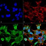 Neuroligin 1 Antibody in Immunocytochemistry (ICC/IF)