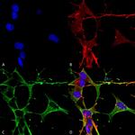 NLGN3 Antibody in Immunocytochemistry (ICC/IF)