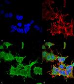 Spectrin beta-4 Antibody in Immunocytochemistry (ICC/IF)