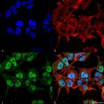 GABRA2 Antibody in Immunocytochemistry (ICC/IF)