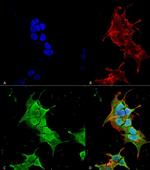 Ankyrin 1 Antibody in Immunocytochemistry (ICC/IF)