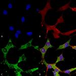 GABRA4 Antibody in Immunocytochemistry (ICC/IF)