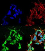 SCN3B Antibody in Immunocytochemistry (ICC/IF)