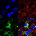 SCN3B Antibody in Immunocytochemistry (ICC/IF)