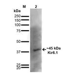 Kir6.1 (KCNJ8) Antibody in Western Blot (WB)