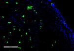 Acrolein Antibody in Immunohistochemistry (IHC)