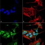 alpha Synuclein Antibody in Immunocytochemistry (ICC/IF)