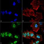 alpha Synuclein Antibody in Immunocytochemistry (ICC/IF)