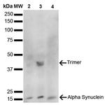 alpha Synuclein Antibody in Western Blot (WB)