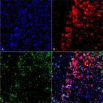 alpha Synuclein Antibody in Immunocytochemistry (ICC/IF)