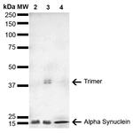 alpha Synuclein Antibody in Western Blot (WB)