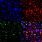 alpha Synuclein Antibody in Immunocytochemistry (ICC/IF)