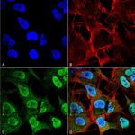 alpha Synuclein Antibody in Immunocytochemistry (ICC/IF)