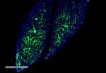 THRA/THRB Antibody in Immunohistochemistry (IHC)