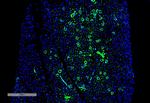 Parvalbumin Antibody in Immunohistochemistry (IHC)