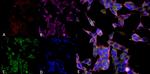 Parvalbumin Antibody in Immunocytochemistry (ICC/IF)