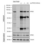 VPS35 Antibody in Immunoprecipitation (IP)