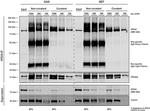 VPS35 Antibody in Immunoprecipitation (IP)