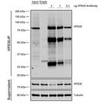 VPS35 Antibody in Immunoprecipitation (IP)