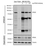 VPS35 Antibody in Immunoprecipitation (IP)