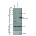 VPS35 Antibody in Immunoprecipitation (IP)