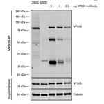 VPS35 Antibody in Immunoprecipitation (IP)