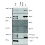 VPS35 Antibody in Immunoprecipitation (IP)