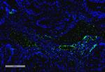 VPS35 Antibody in Immunohistochemistry (IHC)