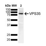 VPS35 Antibody in Immunoprecipitation (IP)